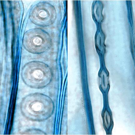 Punteggiature areolate