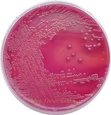 Escherichia coli Escherichia coli enterobatterio, vive in esclusivo rapporto con il tratto gastrointestinale animali a