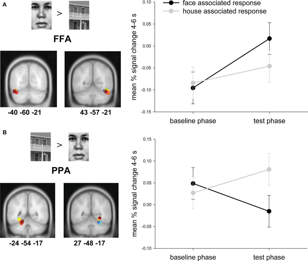 area area di altri oggetti = Parahippocampal place area  Oggetti