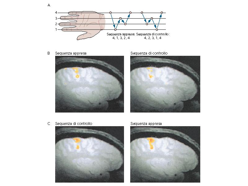 Plasticità della somatotopia L organizzazione somatotopica della corteccia motrice è plastica: può essere modificata con l