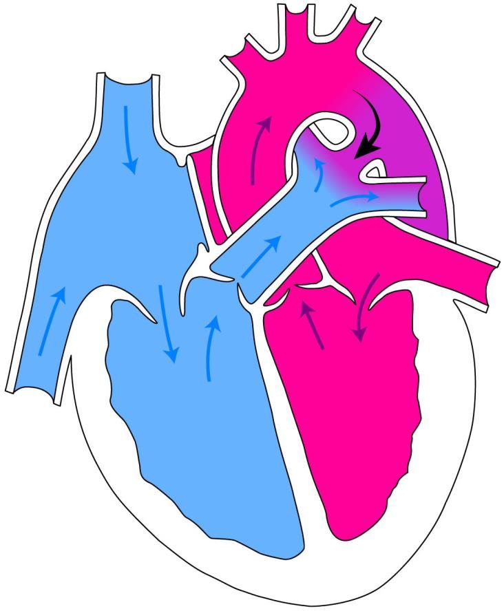 Cenni di anatomia e fisiologia del cuore Ognuna delle due parti si compone di due cavità, una superiore atrio ed una inferiore ventricolo: l atrio è in comunicazione con il rispettivo ventricolo