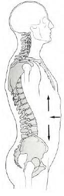 CERVICALGIA L alterazione della posizione neutra del tratto dorsale, nel generare una ipercifosi, modifica l allineamento del