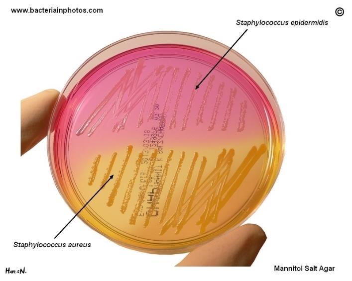 aeruginosa è resistente - inibisce la crescita di gran parte dei microrganismi.