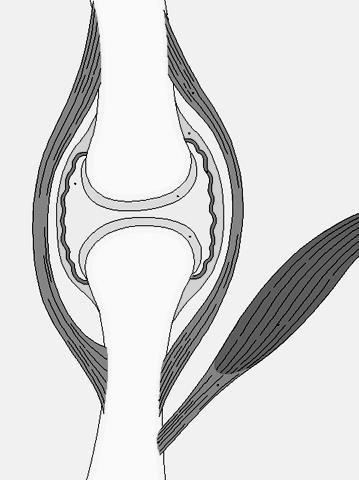 Riveste la superficie dell osso nelle articolazioni Una parte poggia sull osso La superficie articolare non è rivestita dal pericondrio Osso lungo Legamento