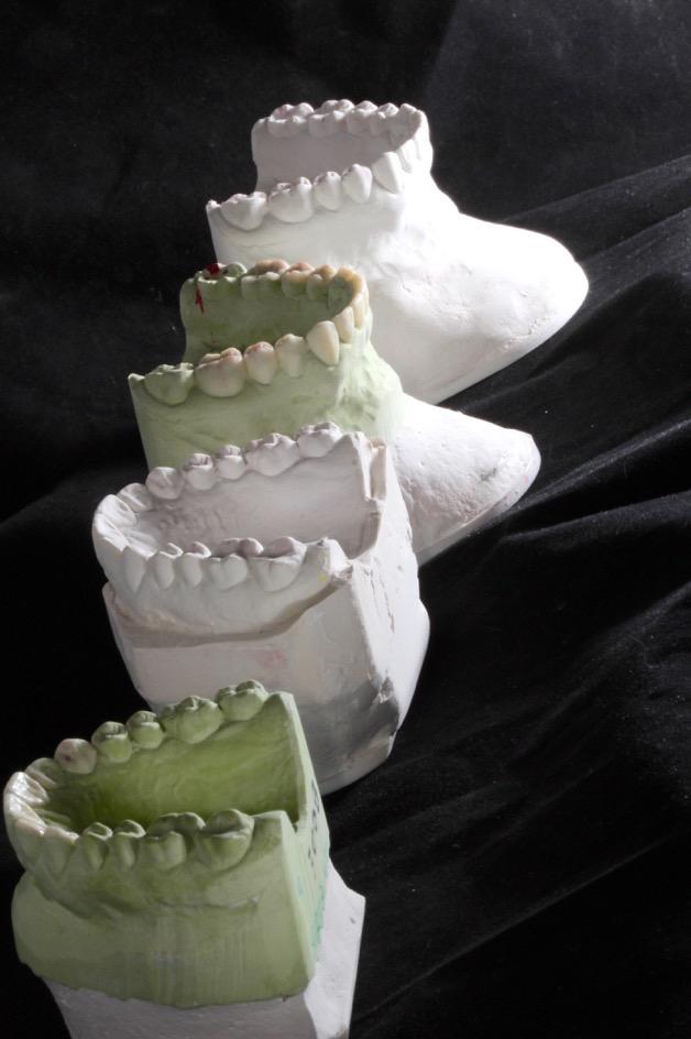 Importanza della stabilità occlusale in Centrica nelle modellazioni dei denti diatorici 2 giorno 10/03/18 ( Leo ) - Morfologia dei denti - concetti di anatomia e modellazione dei settori posteriori