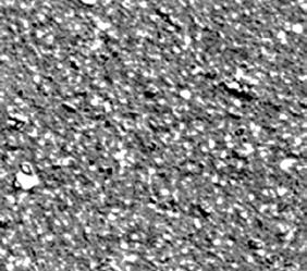 Composite 2 µm Tendenza alla