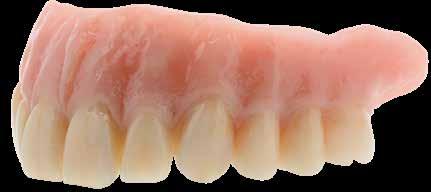 lign possono essere perfettamente combinate con i denti neo. lign. Colori, forme e materiali delle faccette estetiche novo.