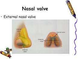 Valvola nasale esterna Valvola nasale interna La valvola nasale è quella porzione anatomica nasale che ha lo scopo di limitare il passaggio dell aria all interno del