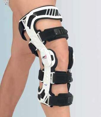 Dopo la rottura del legamento crociato posteriore, il ginocchio si presenta instabile. 2-Dopo. Il sistema di spinta con cuscinetto sagomato mantiene la tibia nella posizione stabilita dal medico.