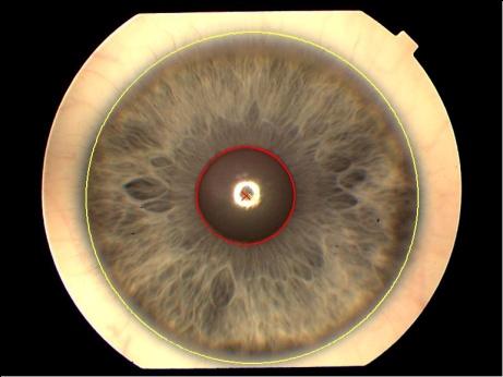 Iris normalization Polarization Calcolati i punti corrispondenti sulla pupilla e sull iride vengono prelevati i pixel