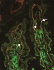 100 50 9 07/2011 I Biopsia