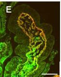 Mucosa intestinale e Celiachia