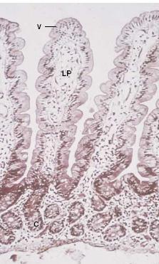 intestinale : da bersaglio (