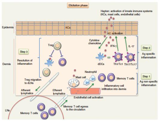In seguito alla migrazione dei linfociti T nel tessuto, ha inizio l infiammazione mediata dai linfociti T.