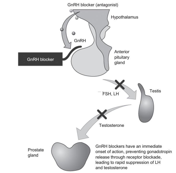 GnRHantagonisti e rischio