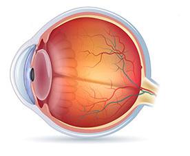 SCELTA DELLA LENTE [ ] Scoprite quale tipologia di lente intraoculare è più adatta voi.