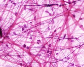 Metodi di rottura delle cellule Meccanici