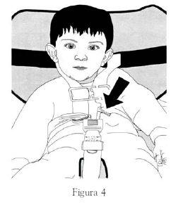 2. Sollevare una cintura spalla sopra una spalla del paziente lasciando il braccio del paziente libero dalla cintura. Inserire la lingua della fibbia nella parte ricevente della fibbia (fig. 4)