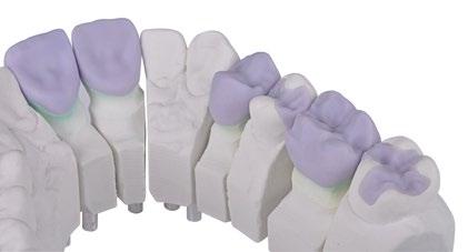 CORONE E PONTI MONOLITICI Protesi cementata su denti naturali ed impianti Disilicato di litio Ivoclar IPS e.max CAD Ivoclar coniuga estetica e resistenza.