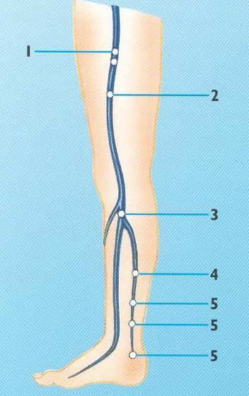Anatomia del sistema vascolare Vene Perforanti 1 Perforanti del canale femorale (Dodd) 2 Laterale di gamba (Hunter) 3 Paratibiale superiore (Boyd) 4