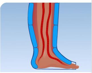 STIFFNESS Lo Stiffness (o rigidità) è la capacità della benda (o calza elastica) di opporsi all espansione del muscolo al momento della sua contrazione.
