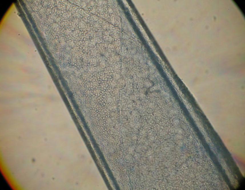 cell/mm 2 2- Separazione roll descemetico 3gg di conservazione a