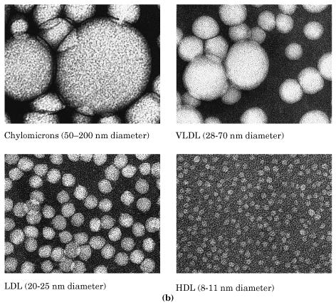 Classi di lipoproteine al microscopio