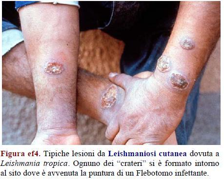 Genere Leishmania patologia ed epidemiologia Leishmania tropica diffusa nelle aree urbane dalla Turchia all India compreso tutto il Medio Oriente.