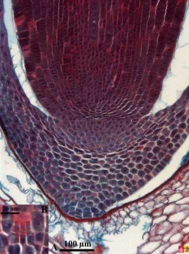 Apice della radice embrionale di Triticum: anche nella radice