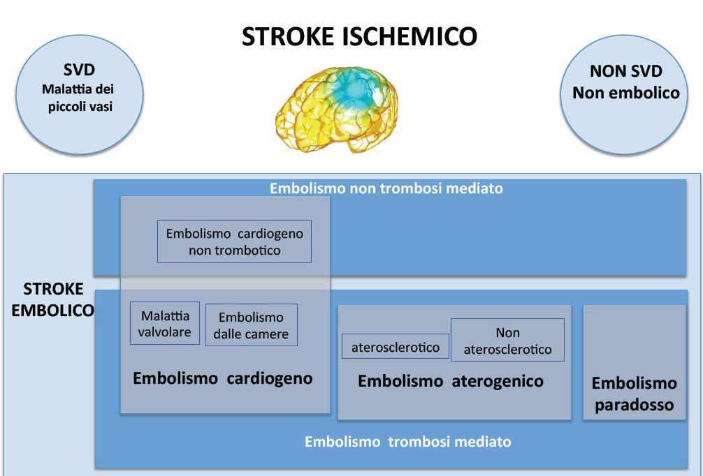 INQUADRAMENTO DIAGNOSTICO: EZIOPATOGENESI Aterosclerosi: Trombosi murale Ulcerazione o rottura della placca con emboli Emorragia intraplacca Origine cardioembolica: Trombi murali