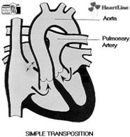 polmonare Dati Epidemiologici Anatomia malformazione relativamente frequente (5-7% di tutte le