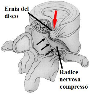 E chiaro che, dove è possibile, dovremmo andare ad agire specificamente sulle cause effettive.