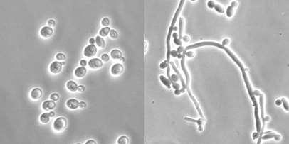 DIMORFISMO La conversione morfologica si accompagna a modificazioni quantitative e qualitative nella composizione della parete: modificazioni nel profilo delle mannoproteine, nella struttura degli