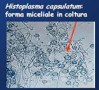 Histoplasma capsulatum