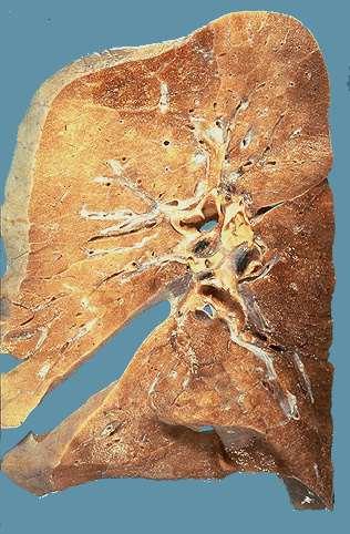 sezione di polmone