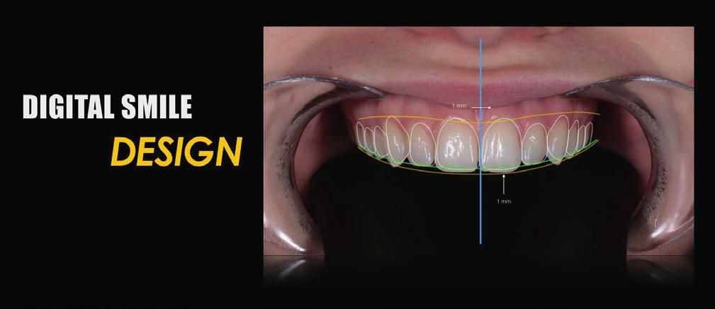 Corso Teorico-Pratico di Ortodonzia Programma Corso Avanzato 1 INCONTRO Pianificazione avanzata del trattamento ortodontico ESTETICA DEL SORRISO Esposizione verticale a riposo e durante il sorriso