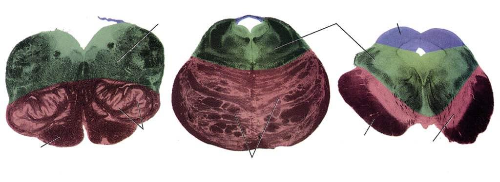 Tegmento Tegmento Tetto Piramide Piede Nucleo olivare inferiore Peduncolo cerebrale Parte basilare