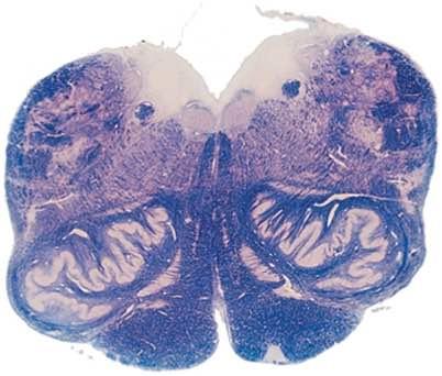 Nuclei propri del