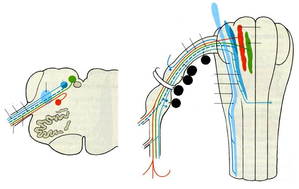 Fibre che somatosensitive Fibre viscerosensitive Nucleo del tratto solitario Nucleo ambiguo Fibre gustative Nucleo spinale del nervo trigemino Ganglio giugiulare Nucleo dorsale del nervo vago Forame