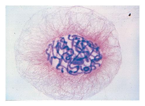 I singoli cromosomi contengono una molecola molto lunga di DNA associata a proteine e sono visibili solo quando le cellula si prepara alla divisione.