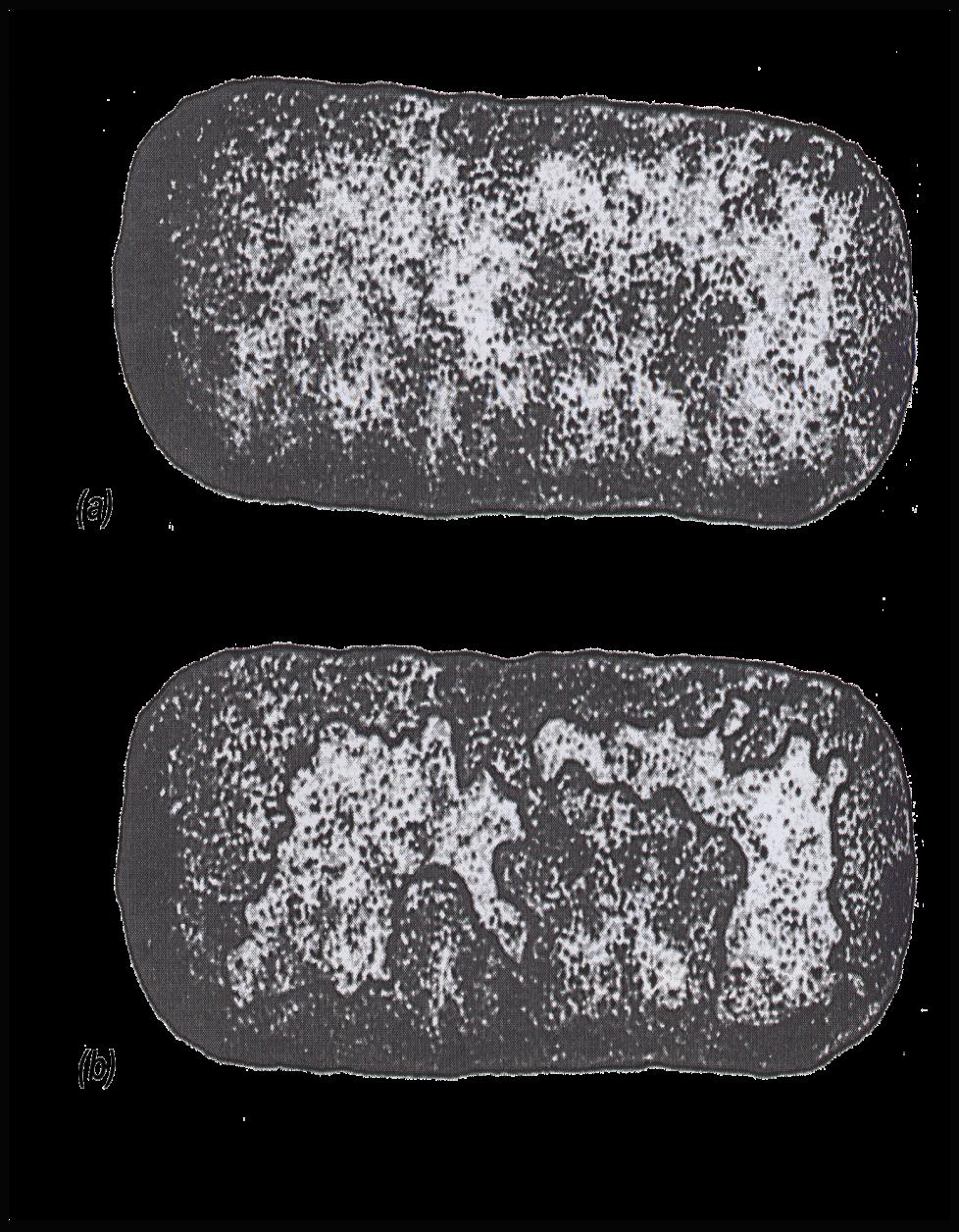 IL NUCLEOIDE BATTERICO Micrografia
