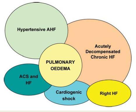 HF Worsening Decompensated HF Stable Slow onset Chronic Heart Failure