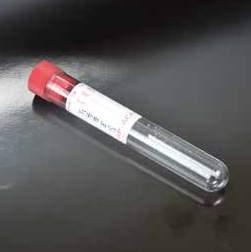 of blood, with label.  CLOT ACTIVATOR TUBES PROVETTE CON ATTIVATORE DELLA COAGULAZIONE PMMA test tubes with clot accelerator for 4 ml of blood, with label. Vol. 4 ml. Ø 13 x 75 mm.