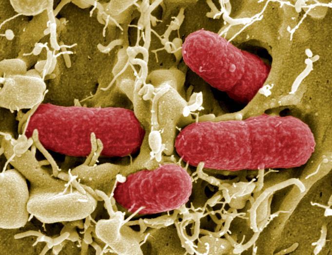 profusa che evolve rapidamente in diarrea emorragica con espulsione di feci ricche di