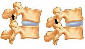 Quando ci pieghiamo il disco si modifica in modo da favorire il movimento della colonna vertebrale. Quando saltiamo il disco permette di attenuare l urto sulle vertebre.