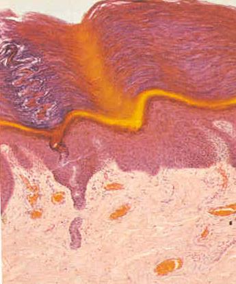 Epitelio pavimentoso pluristratificato cheratinizzato - 1 Ne abbiamo un esempio nella nostra epidermide. A livello dello strato basale o germinativo le cellule si riproducono (mitosi).
