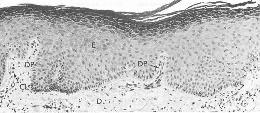 Epitelio pavimentoso pluristratificato cheratinizzato - 2 cellule più appiattite, con processo di