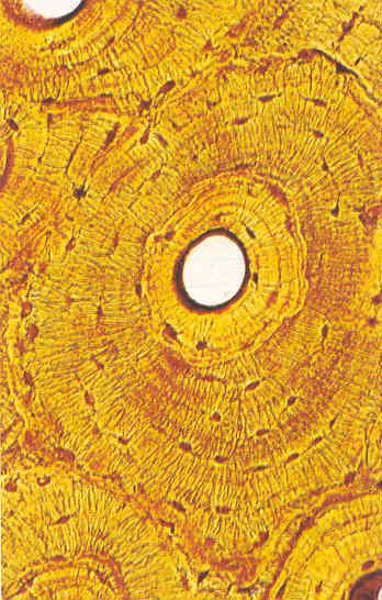 Osteone osservazione microscopica Osteone (sezione trasversale) Lamelle di sostanza intercellulare Canale di Havers Osteociti Il tessuto osseo compatto forma
