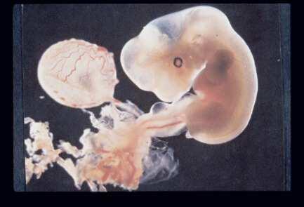 Radiosensibilità del feto La radiosensibilità varia significativamente a