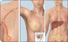 consente di ricavare lo stadio della malattia. Come si ricava la classificazione TNM del carcinoma mammario?